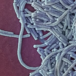 Legionella bacteria, SEM