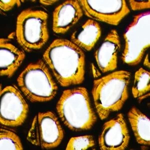 Plasmodesma plant cells, light micrograph