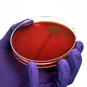 Pneumonia bacteria in a petri dish