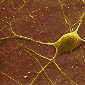 Purkinje nerve cell, SEM