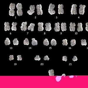Full Set of Male Chromosomes SEM C013 / 7201