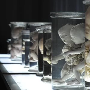 Specimen jars at an anatomy exhibition