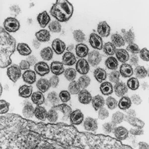 TEM of HIV (AIDS) viruses budding from a T-cell