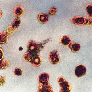 Varicella zoster virus particles, TEM C016 / 9467