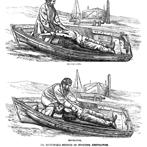 ARTIFICIAL RESPIRATION, 1864. Dr. H. R. Silvesters method for artificial respiration