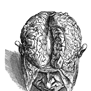 Dissection of the brain (fig. 3). Woodcut from the seventh book of Andreas Vesalius De Humani Corporis Fabrica, published in 1543 at Basel