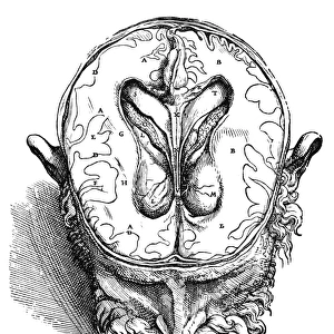 Dissection of the brain (fig. 5). Woodcut from the seventh book of Andreas Vesalius De Humani Corporis Fabrica, published in 1543 at Basel, Switzerland