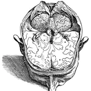 Dissection of the brain (fig. 8). Woodcut from the seventh book of Andreas Vesalius De Humani Corporis Fabrica, published in 1543 at Basel, Switzerland
