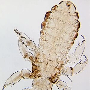Head louse (Pediculus humanus capitis) under microscope
