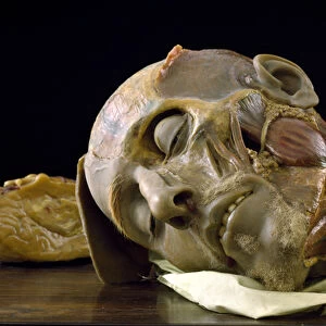 Anatomical model of an old mans head (wax)