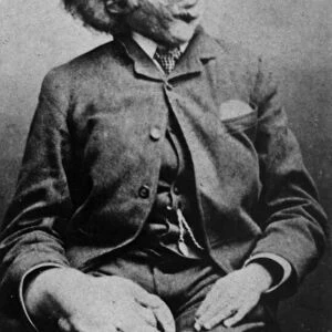 Joseph Carey Merrick, 1889 (b / w photo)