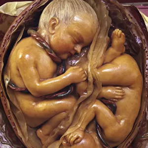 Model of twins in the womb (wax)