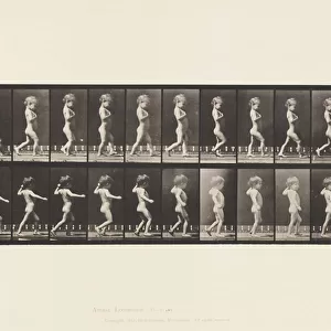 Plate 540. A, Bow Legs; Boy; B, Spinal Caries; Girl Walking, 1885 (collotype on paper)