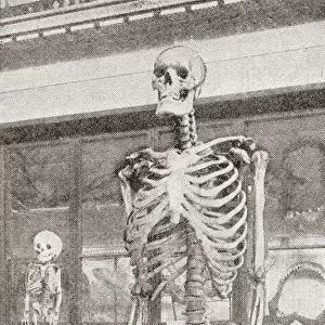 The Skeletons Of Charles Byrne, 1761A