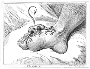 The Gout. Etching, 1799, by James Gillray